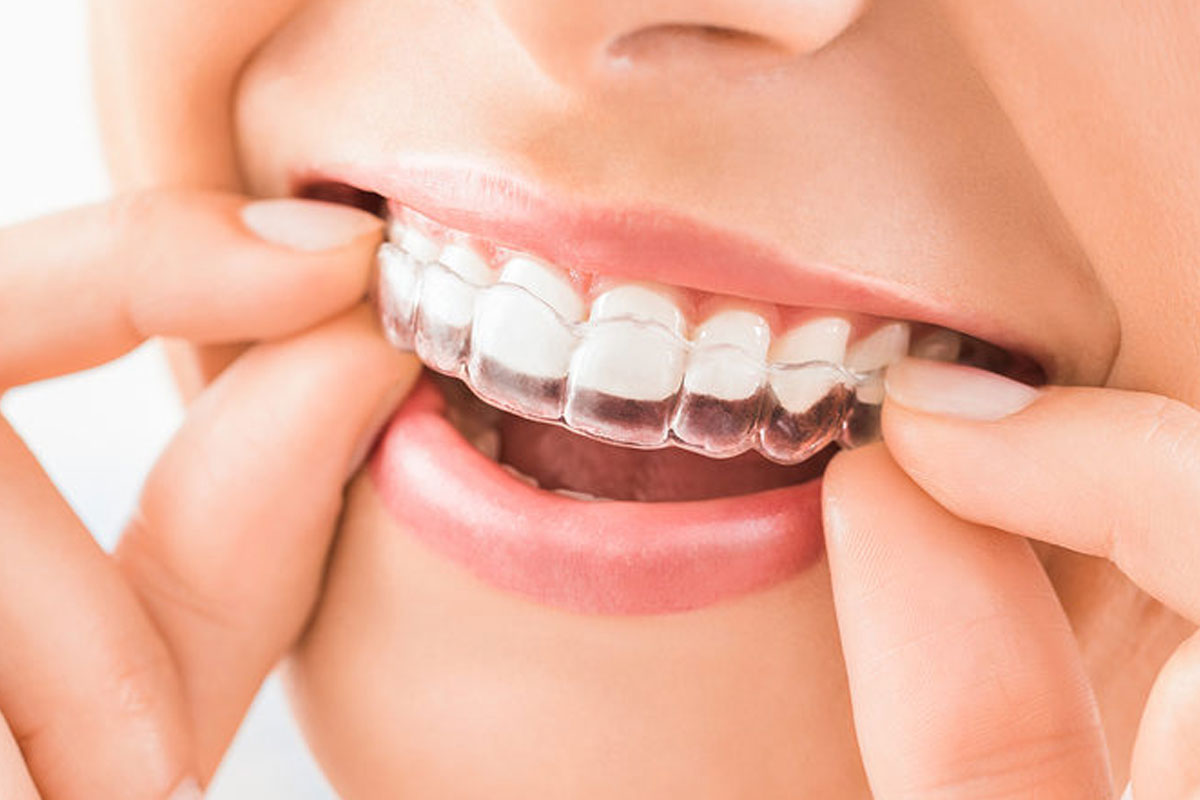 Best Orthodontists in Wakad