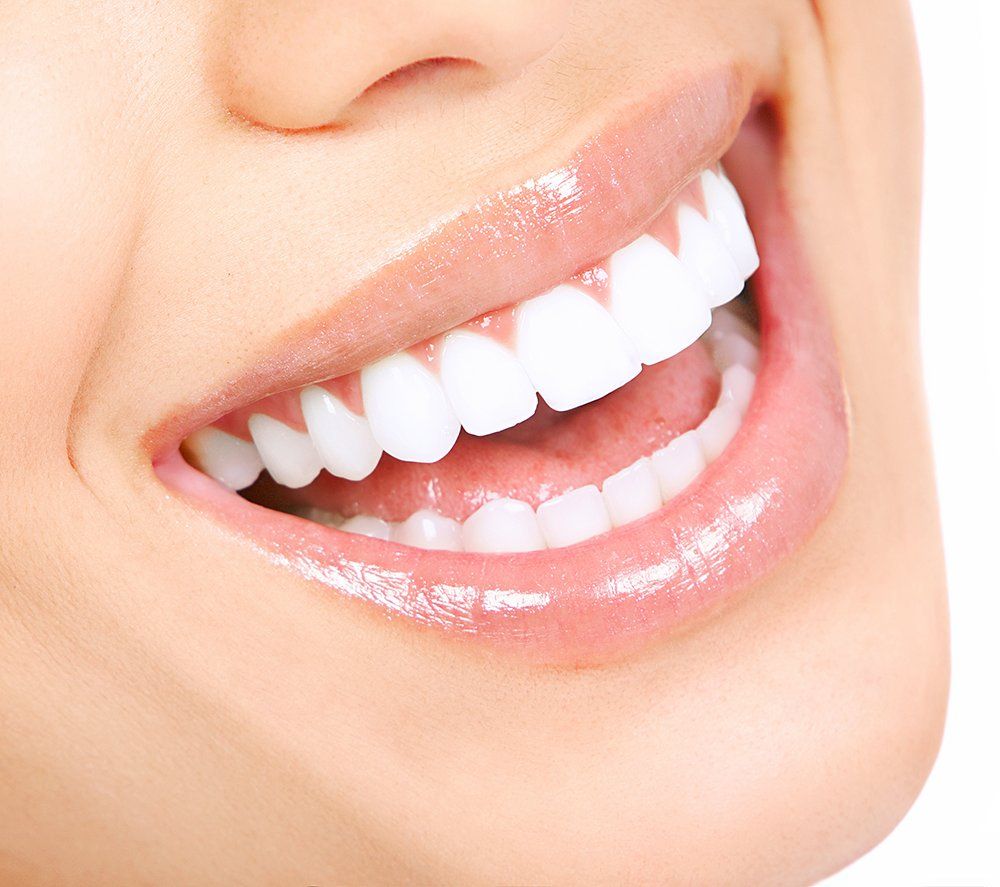 smile design