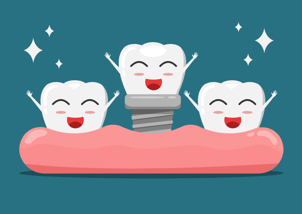 10 Benefits of dental implants to improve your appearance & function