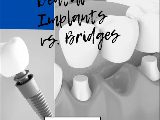 How are dental implants better than crown and bridges?