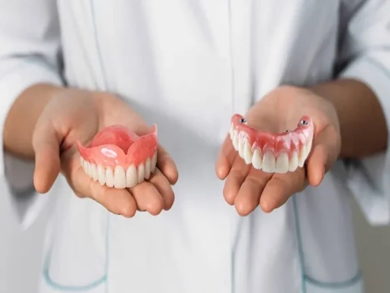 Choosing Dental Implants Over Dentures