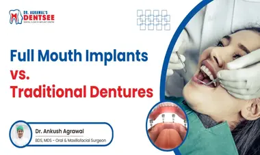 Full Mouth Implants vs. Traditional Dentures