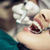 Dental Implant Treatment in Wakad